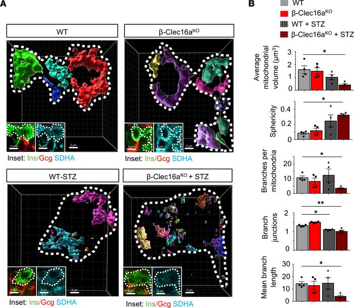 Mitophagy deficiency reveals STZ-induced mitochondrial network defects i...