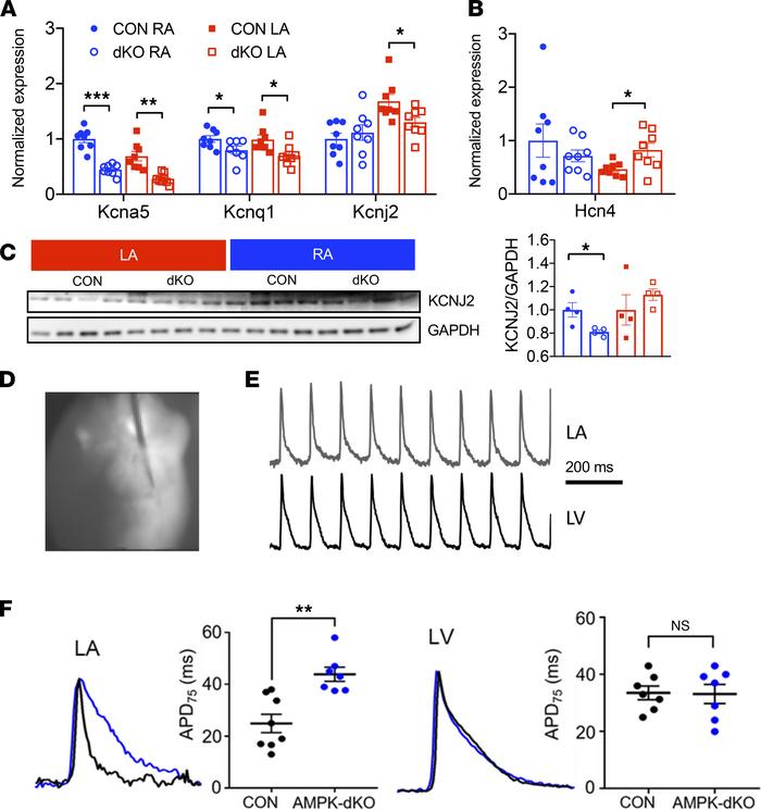 Decreased atrial potassium channel expression and prolonged electrophysi...