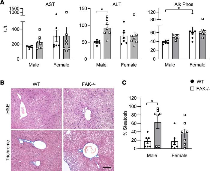 Male and female FAKfl/fl Alb-Cre+ mice (FAK–/–) or FAKfl/fl Alb-Cre– lit...