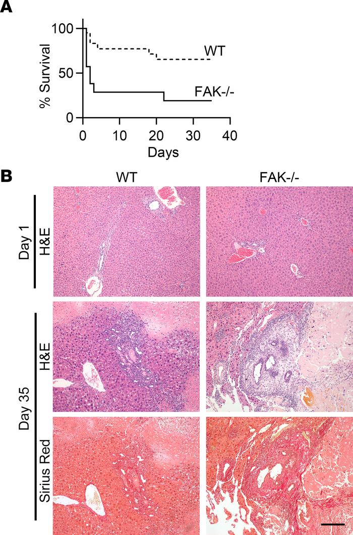 Male and female FAKfl/fl Alb-Cre+ mice (FAK–/–) or FAKfl/fl Alb-Cre– lit...