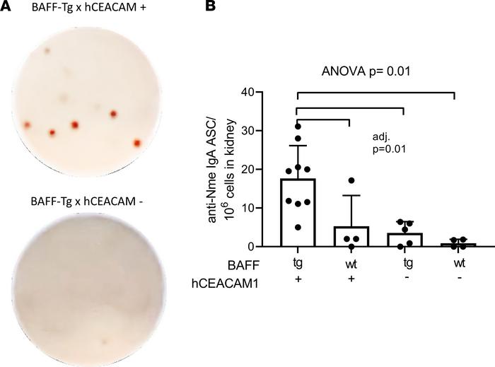 Detection of anti–N. meningitidis IgA-secreting cells in the kidneys of ...