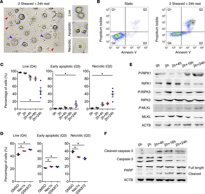 CPB induces cell death by both apoptosis and necroptosis.
(A) Representa...