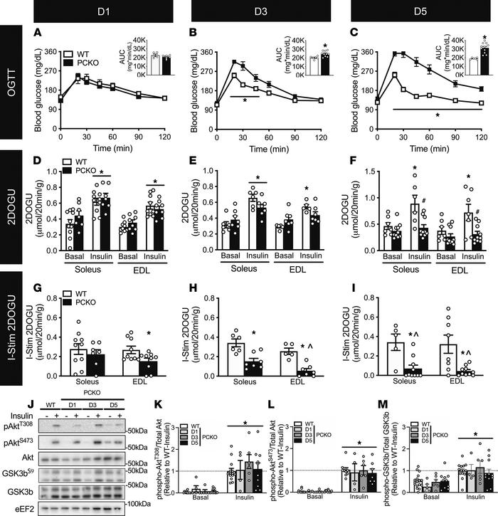 p300 and CBP are required for skeletal muscle insulin-stimulated glucose...