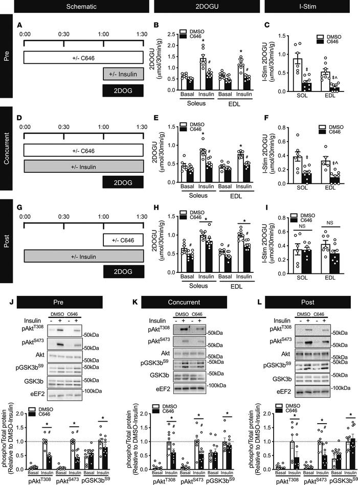 Acute inhibition of p300/CBP activity in skeletal muscle hinders insulin...