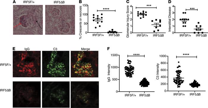 Decreased renal disease in IRF5ΔB mice.
All analyses were done in 5-mont...