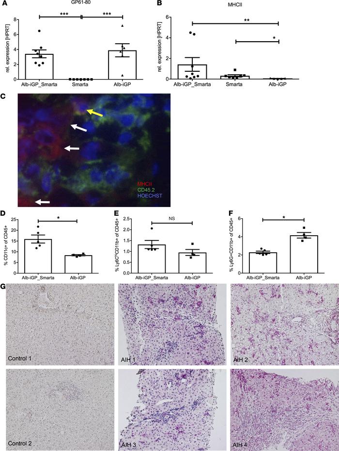 DCs as pathogenic drivers in Alb-iGP_Smarta mice and human AIH.
Hepatoce...