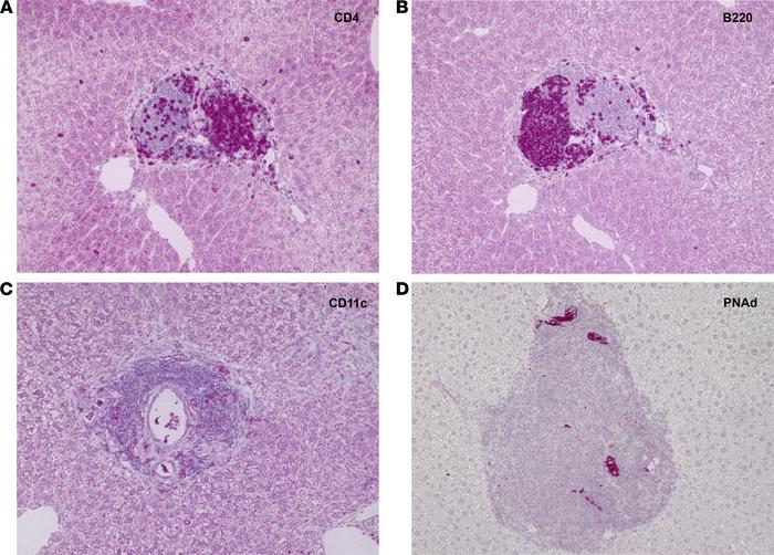 Histological characterization of portal ectopic lymphoid tissue in early...