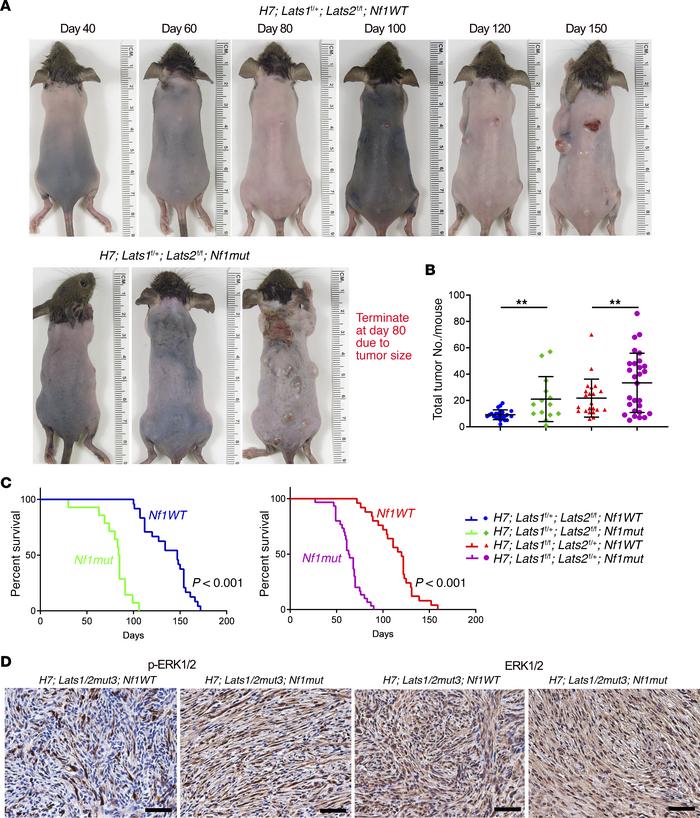 The MAPK pathway is a modifier of schwannomagenesis.
(A) Representative ...