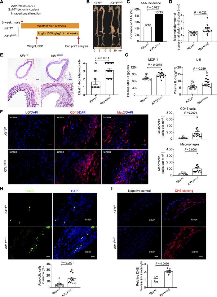 Endothelial cell–specific KLF11 depletion aggravates Pcsk9/AngII-induced...