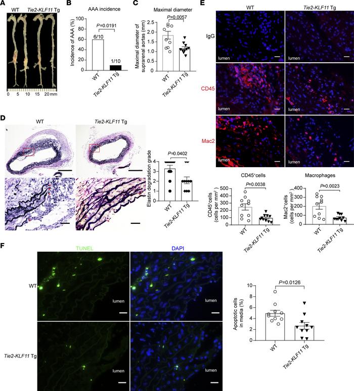 EC-selective overexpression of KLF11 attenuates Pcsk9/AngII-induced AAA....