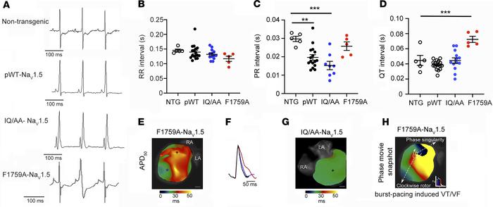 QT interval and ventricular repolarization is not prolonged in IQ/AA tra...