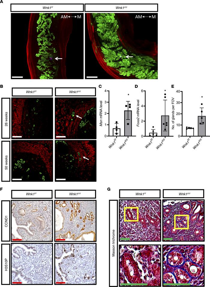 WNK1 ablation altered uterine morphology and microenvironment.
(A) 3D re...