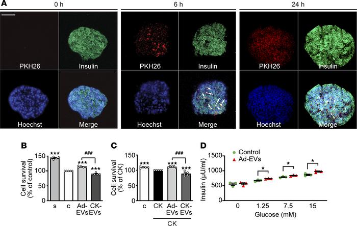 Effect of Ad-EVs and CK-EVs on survival and function of human pancreatic...