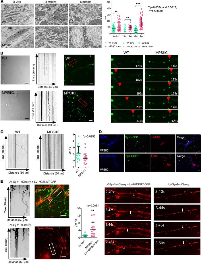 Vesicle transport defects in MPSIIIC neurons.
(A) Microtubules in MPSIII...