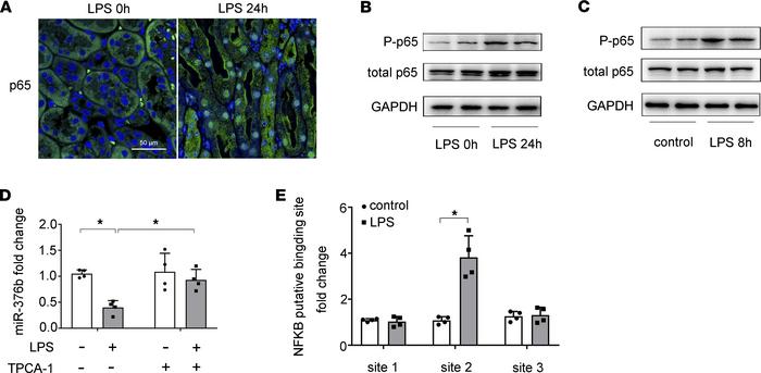 NF-κB mediates the downregulation of miR-376b in LPS-induced AKI.
(A) Im...