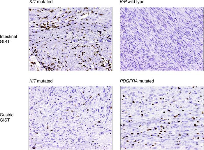 Representative CD3 T cells immunostainings.
Location and genotypes are i...