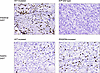 Representative CD3 T cells immunostainings.