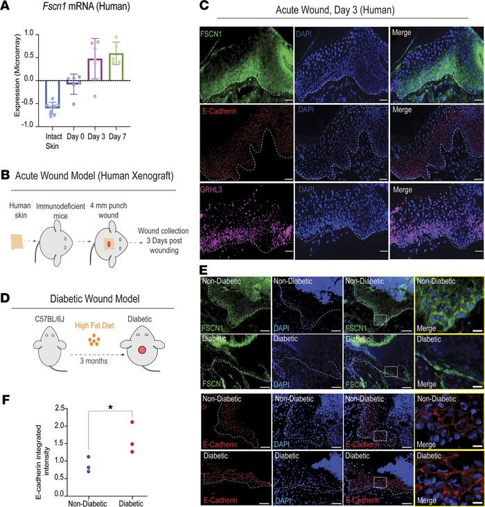 The GRHL3/FSCN1/E-cadherin pathway is activated in acute human wounds an...