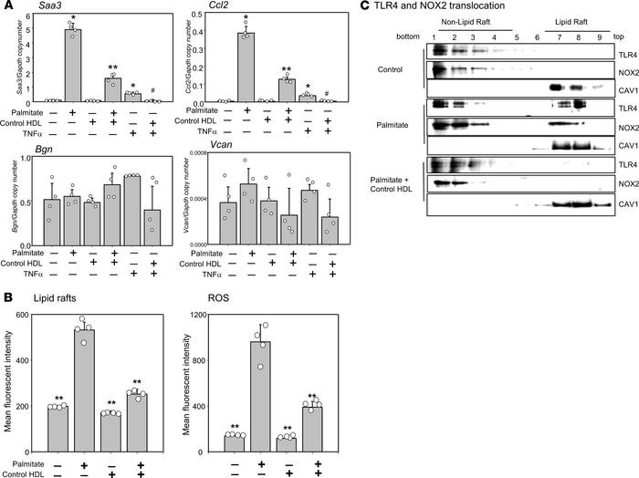 Control HDL inhibits palmitate-induced inflammation in TG-elicited perit...