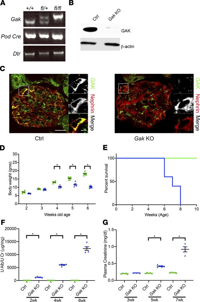 Generation of podocyte-specific Gak-KO mice results in severe proteinuri...