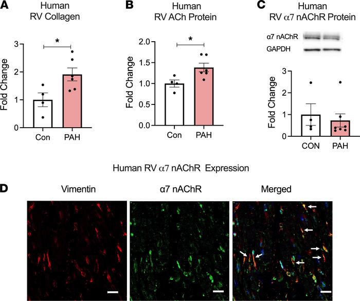 PAH is associated with an increase in RV Collagen and ACh.
(A–C) Collage...
