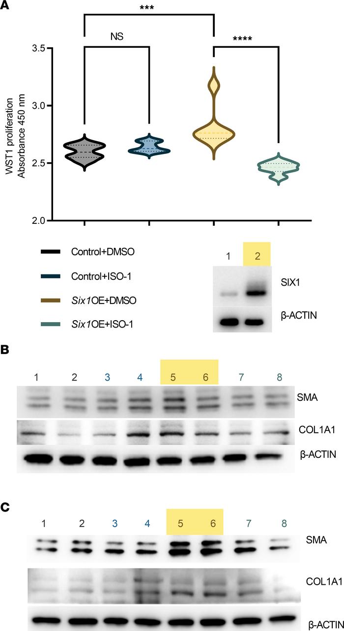 Effects of SIX1 overexpression are blocked by a MIF inhibitor.
(A) WST-1...