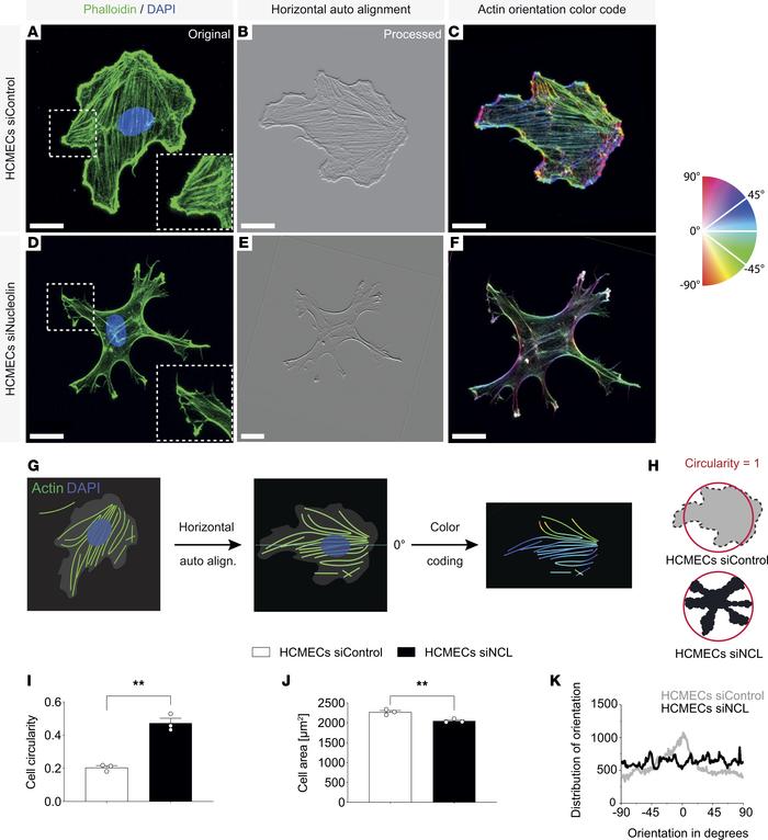 NCL affects HCMEC actin cytoskeleton orientation in vitro.
(A–F) HCMEC t...