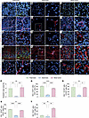 Nucleolin is expressed in endothelial and perivascular cells during human b