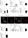 NCL positively regulates endothelial glucose metabolism via glycolytic enzy