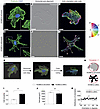 NCL affects HCMEC actin cytoskeleton orientation in vitro.