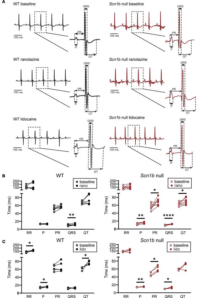 ECG recordings from WT and Scn1b-null mice before and after ranolazine o...