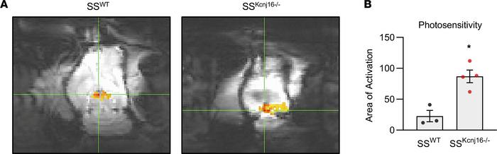 fMRI shows increased photosensitivity in SSKcnj16–/– rats.
(A) Represent...