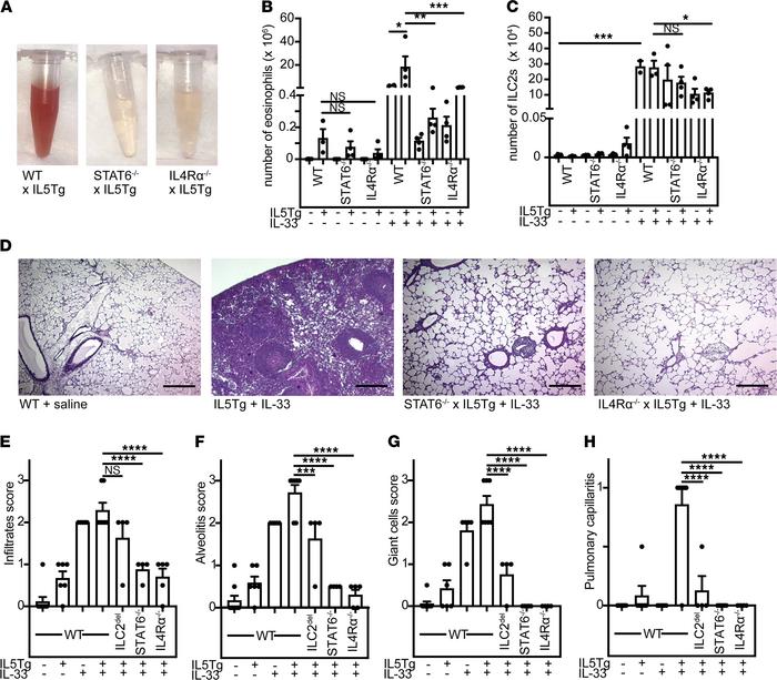 Deficiency of IL4Rα signaling protects from vasculitis in hypereosinophi...
