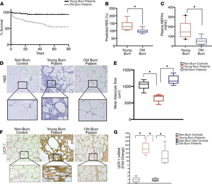 Failure of burn-induced beige fat formation in aged burn patients.
(A) K...