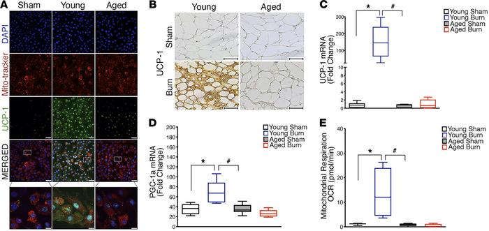 Failure of burn-induced beige fat formation in aged mice.
(A) Differenti...