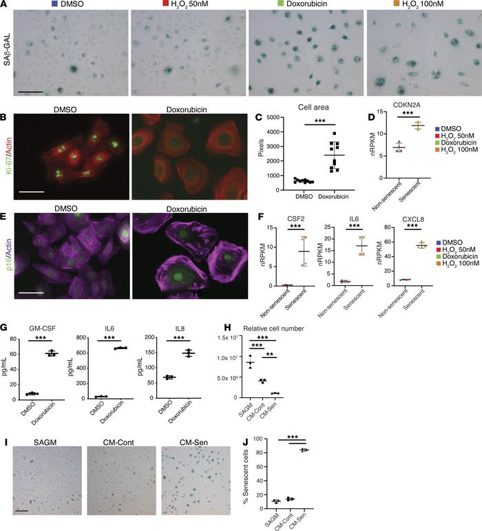 Establishing in vitro senescent lung epithelial cell models.
(A) SAECs s...