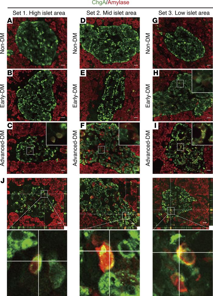 Immunohistochemical evidence of conversion from endocrine to exocrine ce...