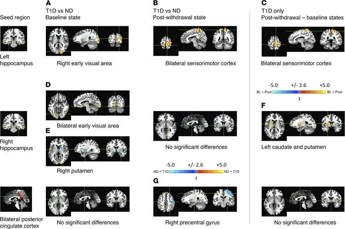 Seed-based functional connectivity maps.
Seed masks were extracted from ...