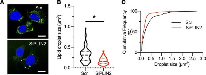 Downregulation of PLIN2 reduces lipid droplets in INS1 cells.
(A) Repres...