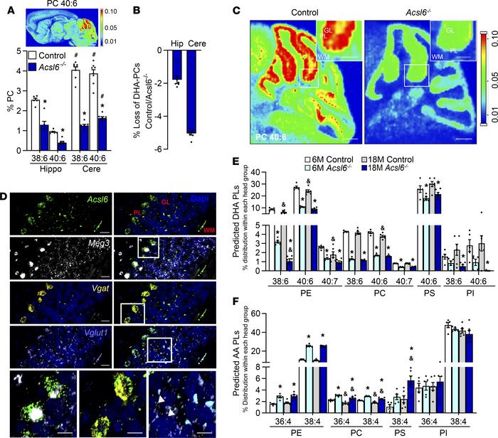 
Acsl6 deletion results in DHA deficiency in the cerebellum during aging...