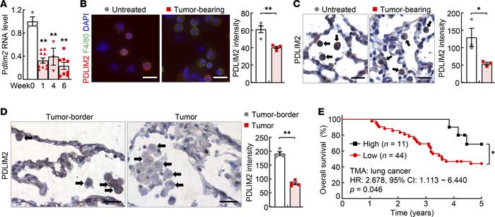 Pathogenic and clinical relevance of PDLIM2 repression in AMs.
(A) qPCR ...