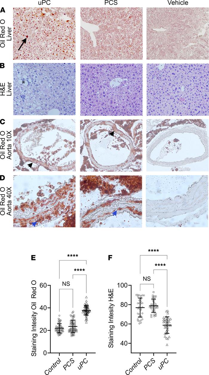 Hepatic and aortic wall lipid accumulation in response to unconjugated p...