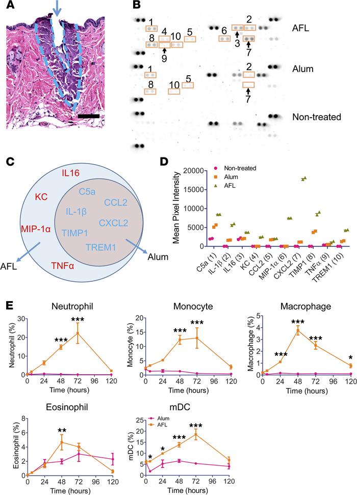 AFL induces strong local inflammation.
(A) Lateral back skin of BALB/c m...
