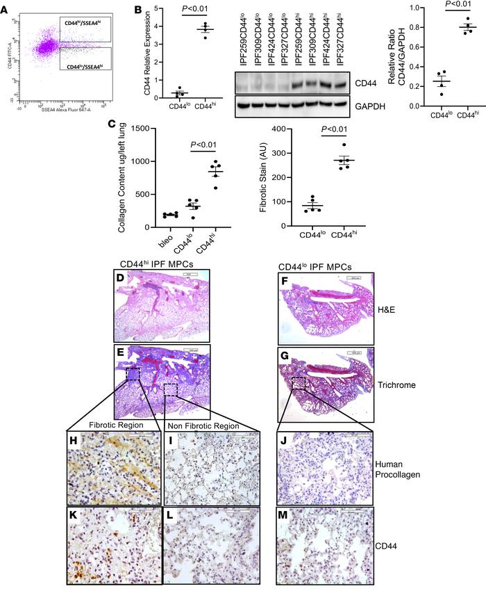 CD44hi IPF MPCs are more fibrogenic than CD44lo IPF MPCs.
(A–E) NSG mice...