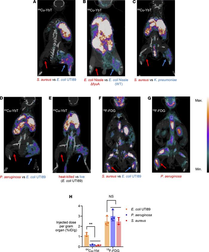 
64Cu-YbT specifically identifies FyuA-expressing bacteria in vivo.
PET/...
