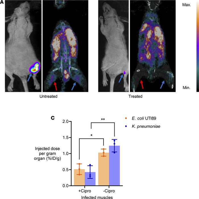 
64Cu-YbT can be used to monitor antibiotic treatment efficacy.
Biolumin...