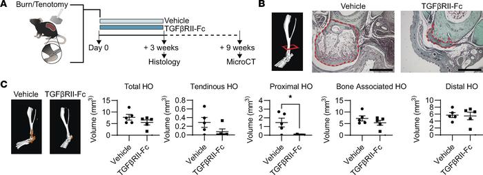 Effects of ligand trap (TGF-βRII-Fc) treatment on HO formation.
(A) Grap...