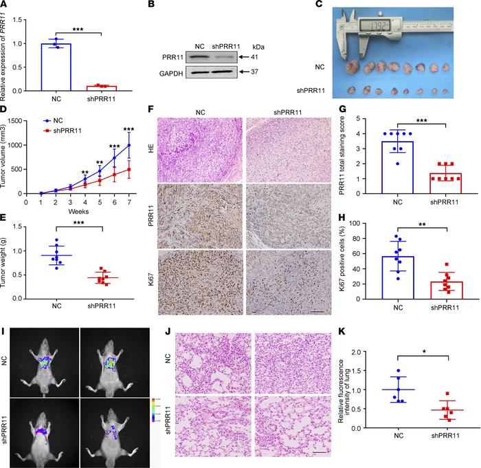 Reduction in PRR11 expression attenuated the in vivo proliferation and m...