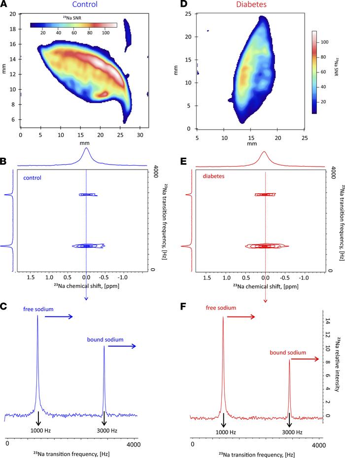 Axial localization of sodium using 23Na GE protocol.
(A and D) The contr...