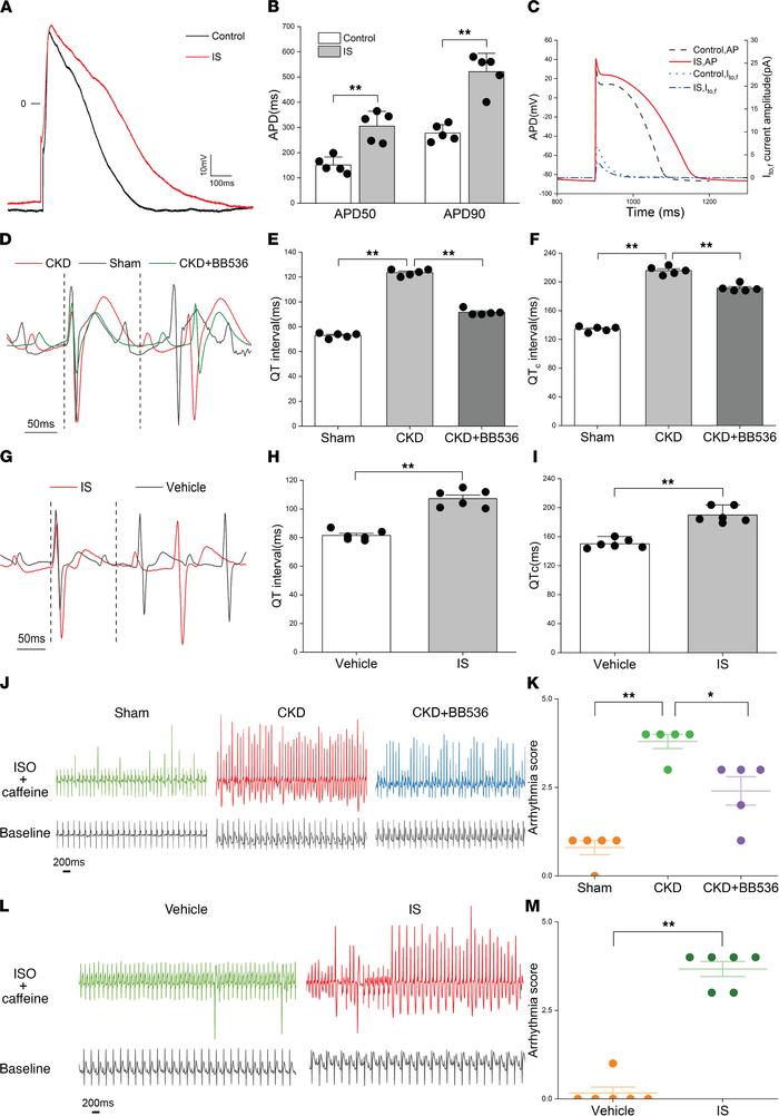 IS prolonged APD of NRVMs and increased the susceptibility to ventricula...